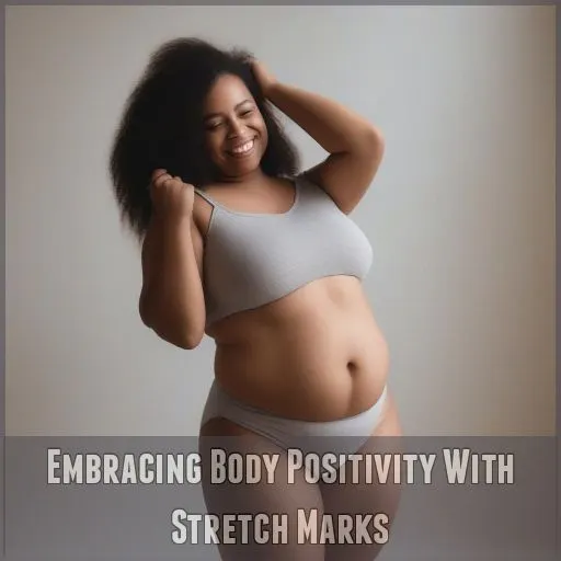 Embracing Body Positivity With Stretch Marks