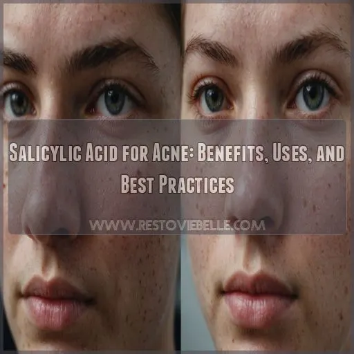 how to use salicylic acid for acne