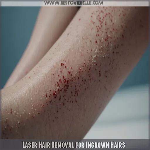 Laser Hair Removal for Ingrown Hairs