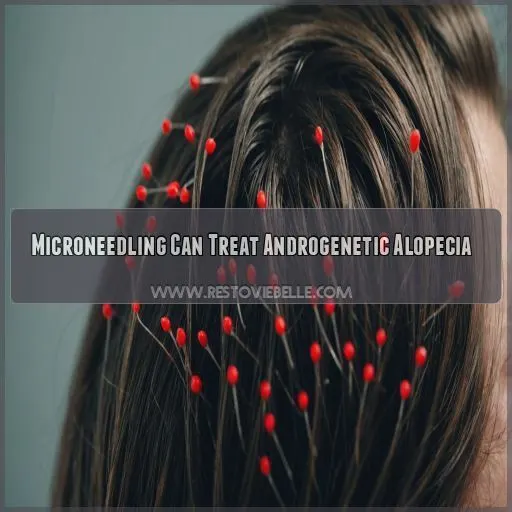 Microneedling Can Treat Androgenetic Alopecia