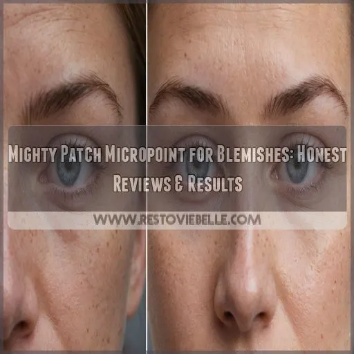 mighty patch micropoint for blemishes reviews