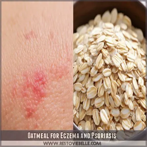 Oatmeal for Eczema and Psoriasis