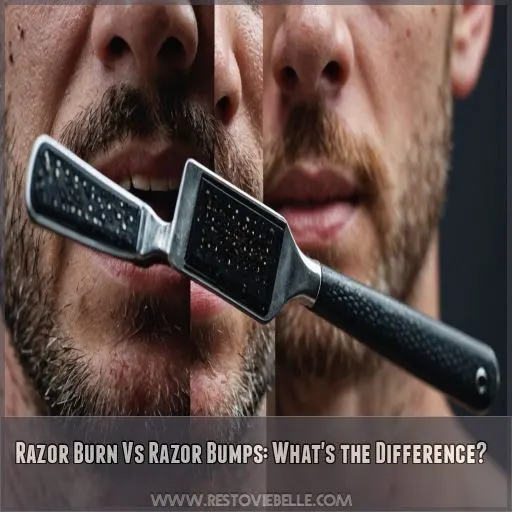 Razor Burn Vs Razor Bumps: What