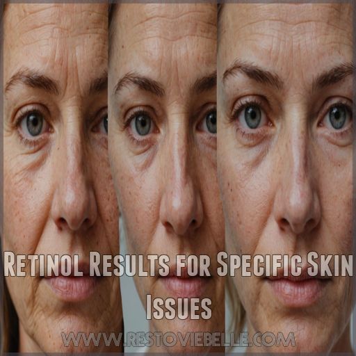 Retinol Results for Specific Skin Issues