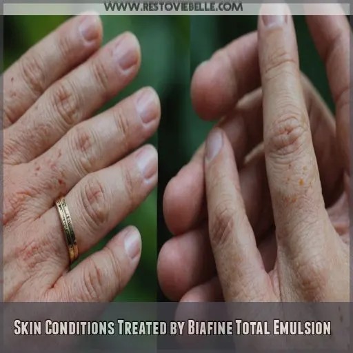 Skin Conditions Treated by Biafine Total Emulsion