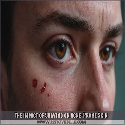 The Impact of Shaving on Acne-Prone Skin