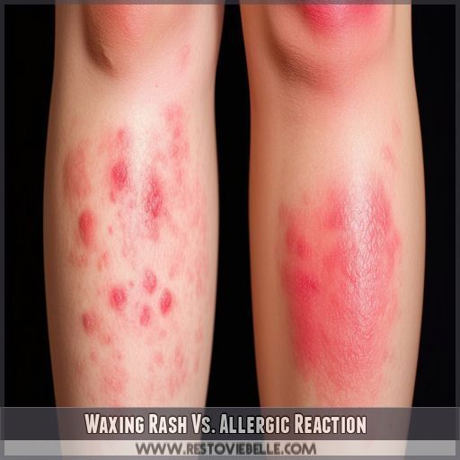 Waxing Rash Vs. Allergic Reaction