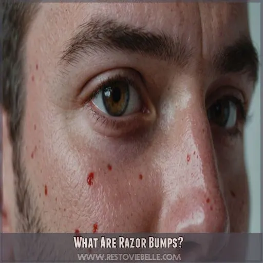 What Are Razor Bumps