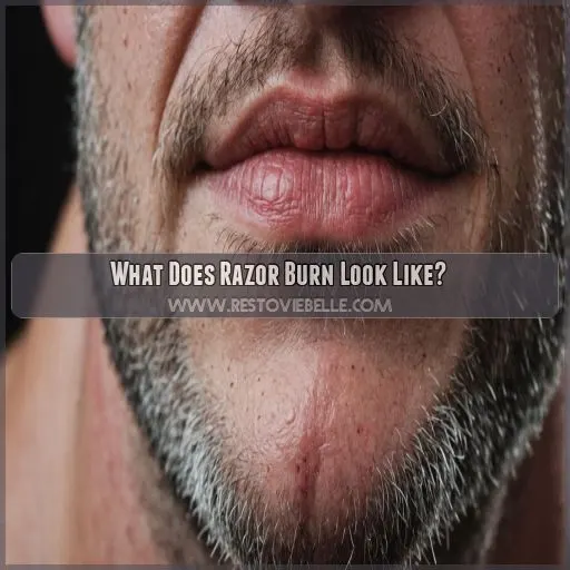 What Does Razor Burn Look Like