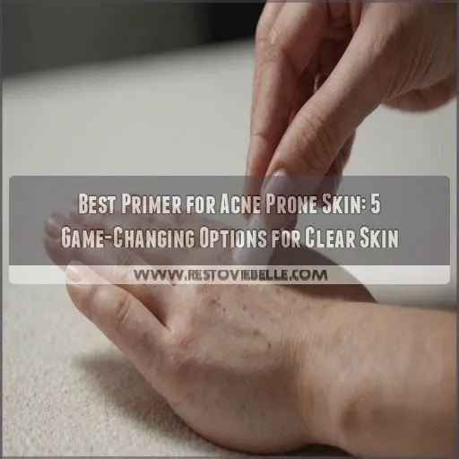 best primer for acne prone skin