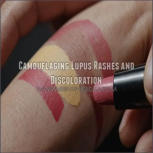 Camouflaging Lupus Rashes and Discoloration