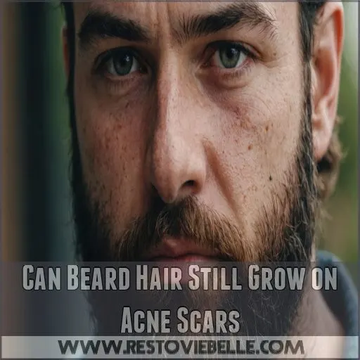 Can Beard Hair Still Grow on Acne Scars