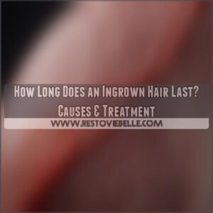 how long does an ingrown hair last