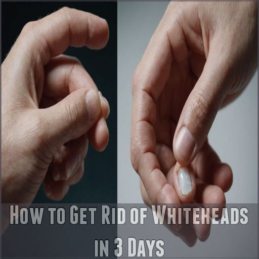 How to Get Rid of Whiteheads in 3 Days