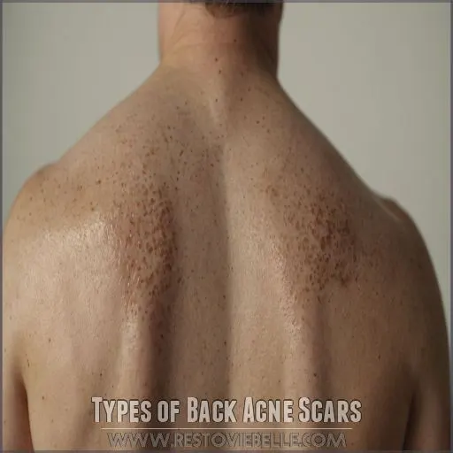 Types of Back Acne Scars