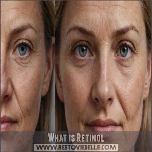 What is Retinol