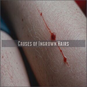 Causes of Ingrown Hairs