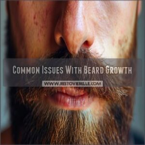 Common Issues With Beard Growth