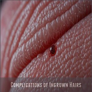 Complications of Ingrown Hairs