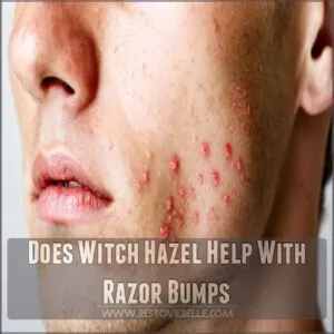 does witch hazel help with razor bumps