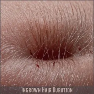 Ingrown Hair Duration