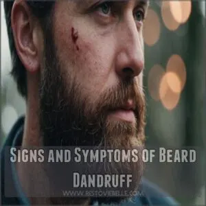 Signs and Symptoms of Beard Dandruff