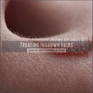 Treating Ingrown Hairs