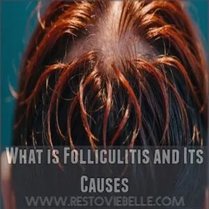 What is Folliculitis and Its Causes