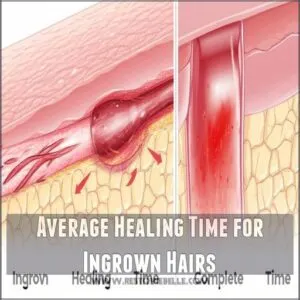 Average Healing Time for Ingrown Hairs