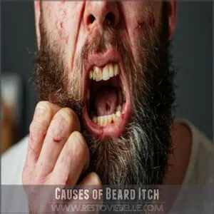 Causes of Beard Itch