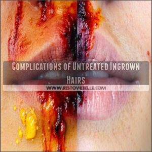 Complications of Untreated Ingrown Hairs