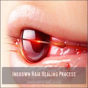 Ingrown Hair Healing Process