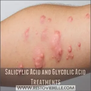 Salicylic Acid and Glycolic Acid Treatments