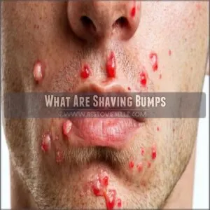 What Are Shaving Bumps