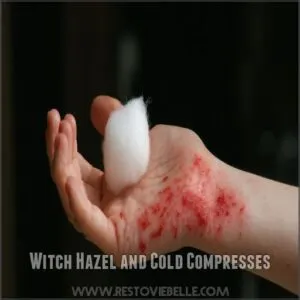 Witch Hazel and Cold Compresses