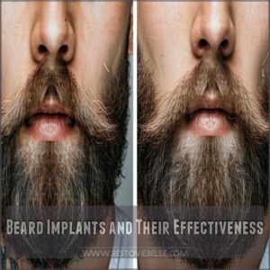 Beard Implants and Their Effectiveness