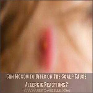 Can Mosquito Bites on The Scalp Cause Allergic Reactions