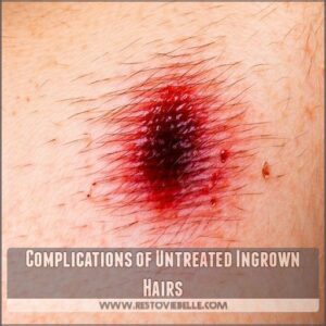 Complications of Untreated Ingrown Hairs