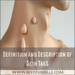 Definition and Description of Skin Tags