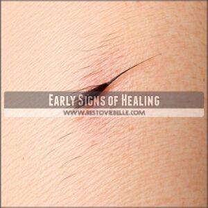 Early Signs of Healing