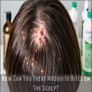 How Can You Treat Mosquito Bites on The Scalp