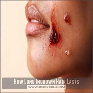 How Long Ingrown Hair Lasts