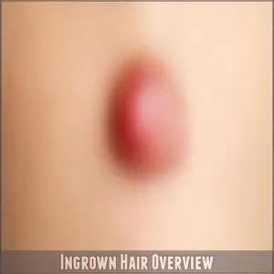 Ingrown Hair Overview