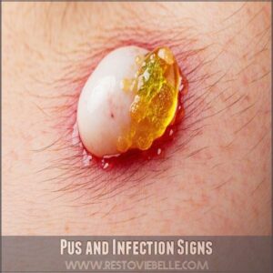 Pus and Infection Signs