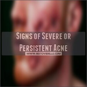 Signs of Severe or Persistent Acne