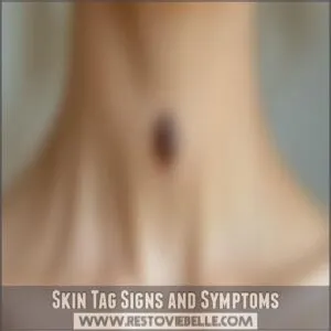 Skin Tag Signs and Symptoms